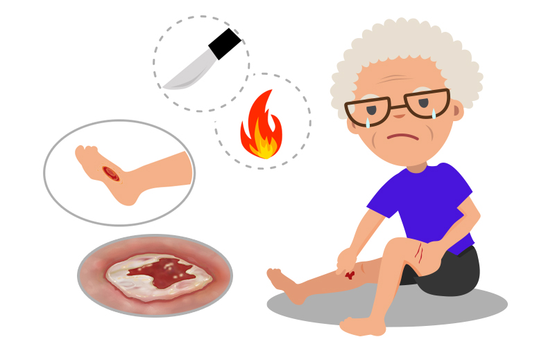 認識及處理3大傷口種類